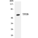 Western Blot - Anti-TFEB Antibody (R12-3617) - Antibodies.com