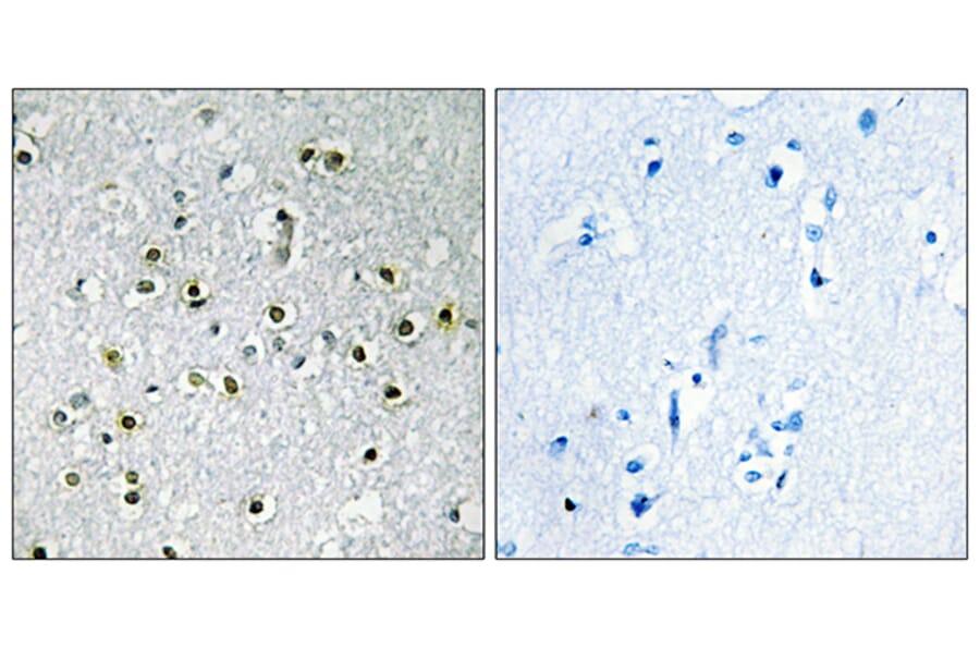 Immunohistochemistry - Anti-TFE3 Antibody (C10430) - Antibodies.com