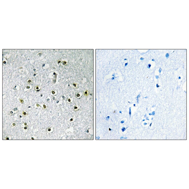 Immunohistochemistry - Anti-TFE3 Antibody (C10430) - Antibodies.com