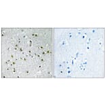 Immunohistochemistry - Anti-TFE3 Antibody (C10430) - Antibodies.com