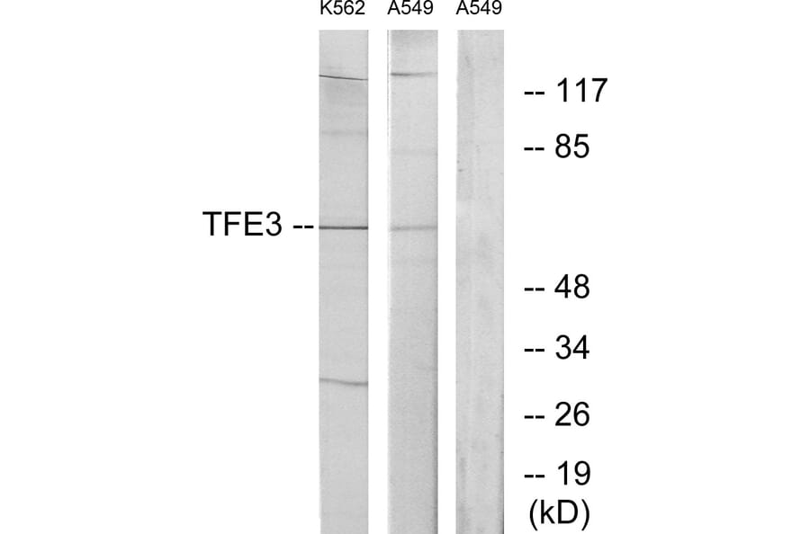 Western Blot - Anti-TFE3 Antibody (C10430) - Antibodies.com