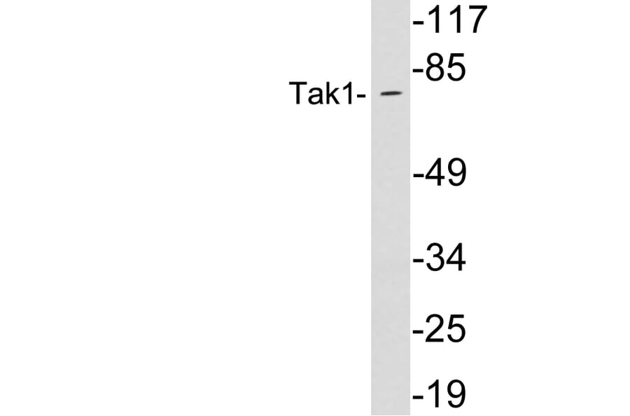 Western Blot - Anti-Tak1 Antibody (R12-2373) - Antibodies.com