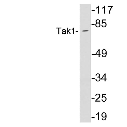 Western Blot - Anti-Tak1 Antibody (R12-2373) - Antibodies.com
