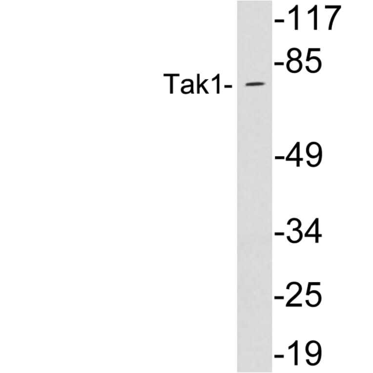 Western Blot - Anti-Tak1 Antibody (R12-2373) - Antibodies.com
