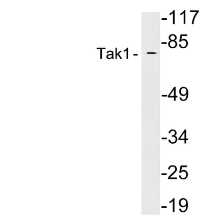 Western Blot - Anti-Tak1 Antibody (R12-2374) - Antibodies.com