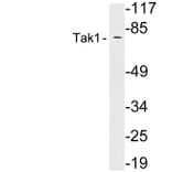 Western Blot - Anti-Tak1 Antibody (R12-2374) - Antibodies.com