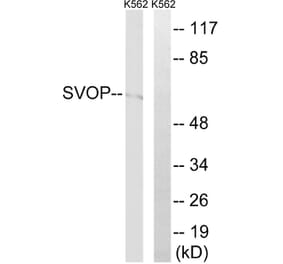 Western Blot - Anti-SVOP Antibody (C18999) - Antibodies.com