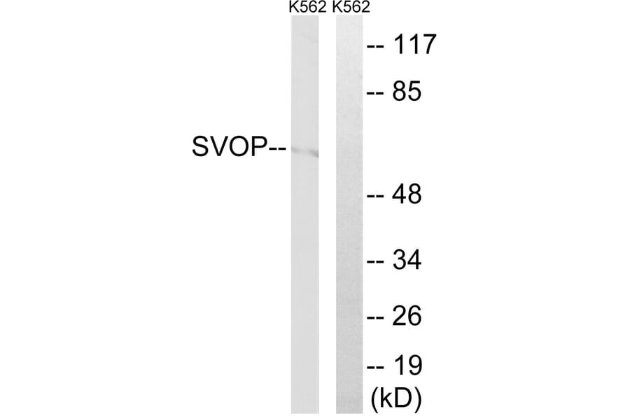 Western Blot - Anti-SVOP Antibody (C18999) - Antibodies.com