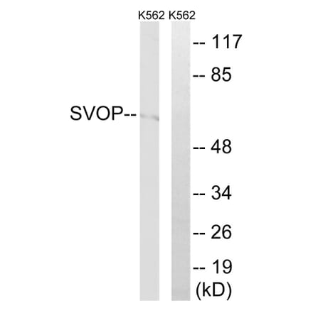 Western Blot - Anti-SVOP Antibody (C18999) - Antibodies.com