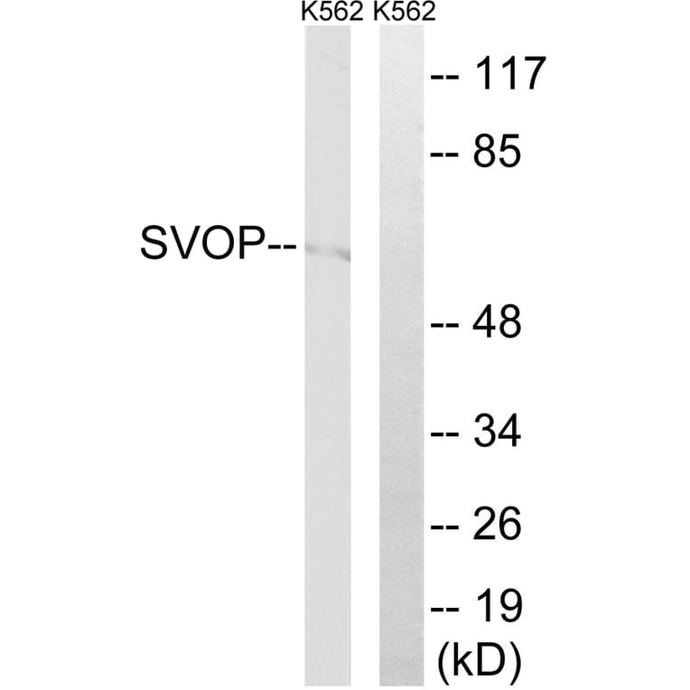 Western Blot - Anti-SVOP Antibody (C18999) - Antibodies.com