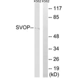 Western Blot - Anti-SVOP Antibody (C18999) - Antibodies.com