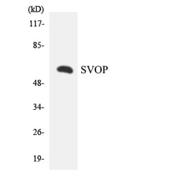 Western Blot - Anti-SVOP Antibody (R12-3576) - Antibodies.com