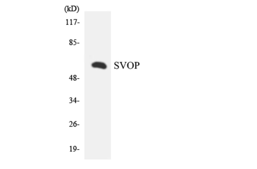 Western Blot - Anti-SVOP Antibody (R12-3576) - Antibodies.com