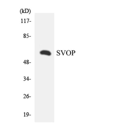Western Blot - Anti-SVOP Antibody (R12-3576) - Antibodies.com