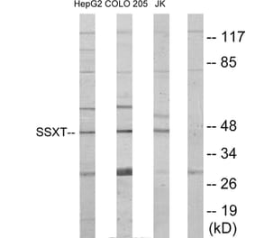 Western Blot - Anti-SSXT Antibody (C11081) - Antibodies.com