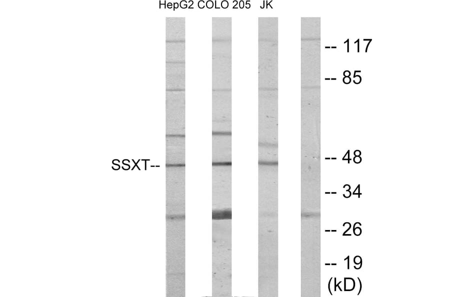 Western Blot - Anti-SSXT Antibody (C11081) - Antibodies.com