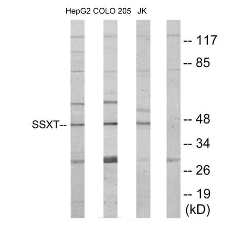Western Blot - Anti-SSXT Antibody (C11081) - Antibodies.com