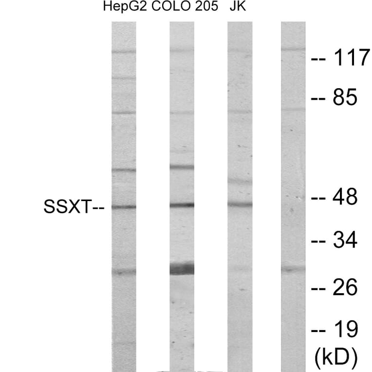 Western Blot - Anti-SSXT Antibody (C11081) - Antibodies.com