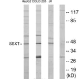 Western Blot - Anti-SSXT Antibody (C11081) - Antibodies.com