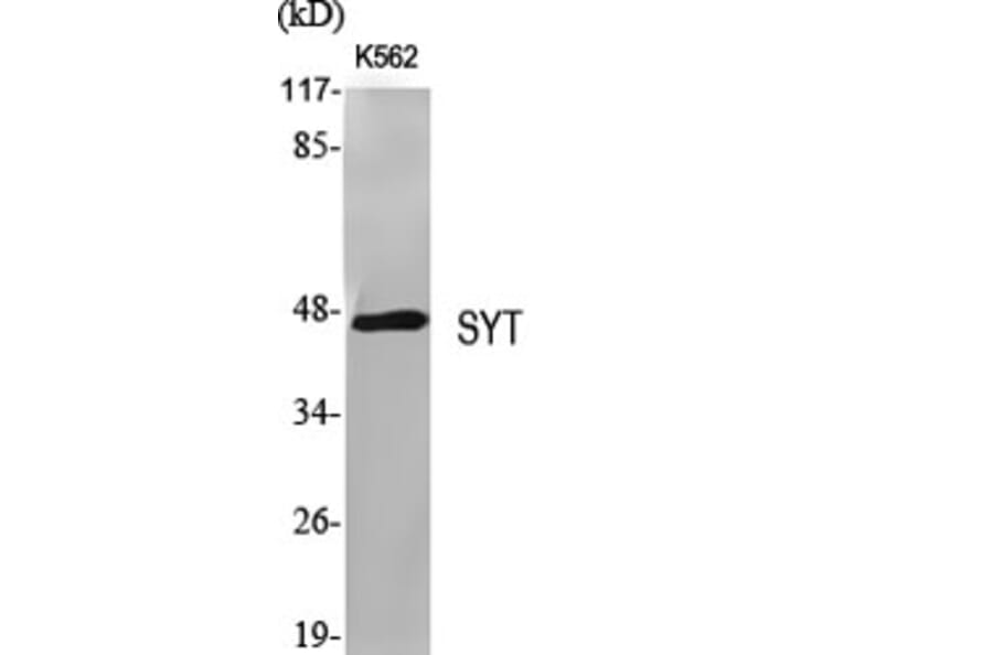 Western Blot - Anti-SSXT Antibody (C11081) - Antibodies.com