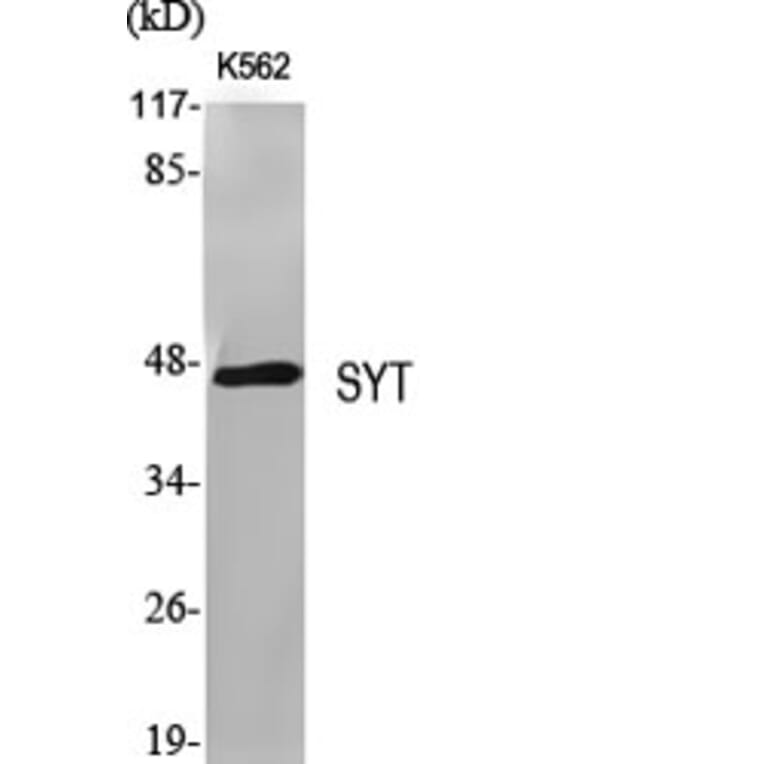 Western Blot - Anti-SSXT Antibody (C11081) - Antibodies.com