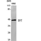 Western Blot - Anti-SSXT Antibody (C11081) - Antibodies.com