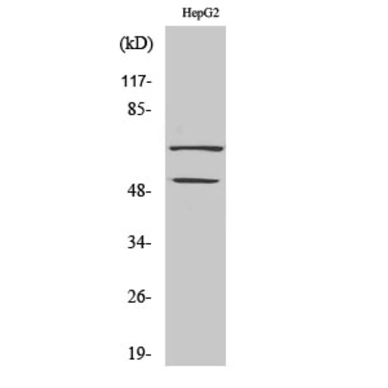 Western Blot - Anti-SSXT Antibody (C11081) - Antibodies.com