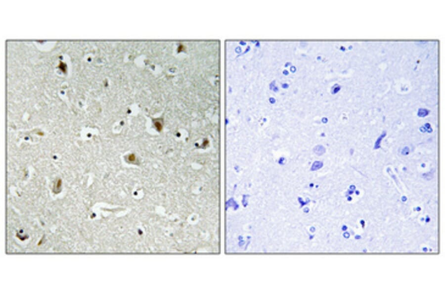 Immunohistochemistry - Anti-SPI1 Antibody (C10414) - Antibodies.com