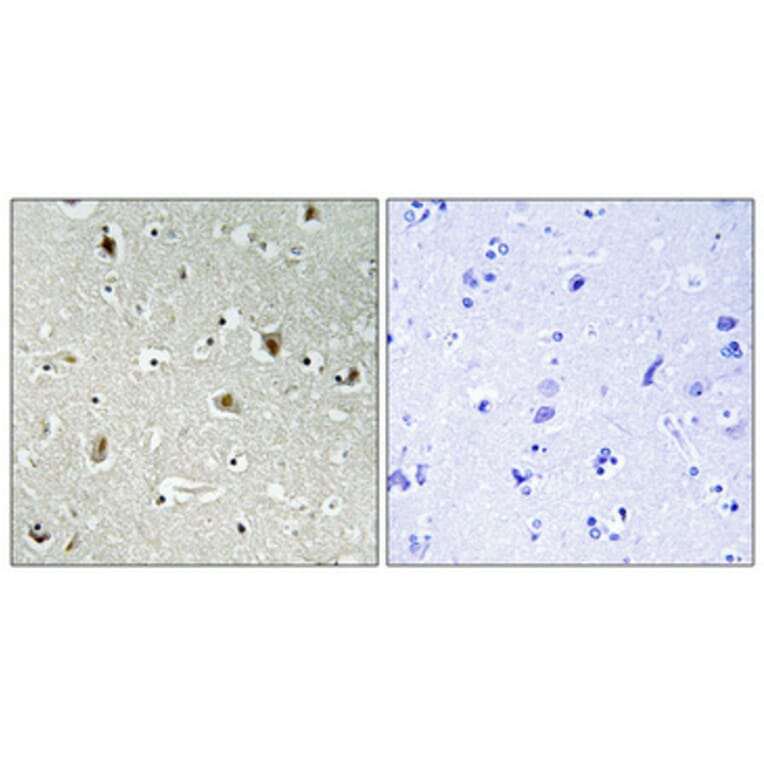 Immunohistochemistry - Anti-SPI1 Antibody (C10414) - Antibodies.com