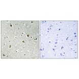 Immunohistochemistry - Anti-SPI1 Antibody (C10414) - Antibodies.com