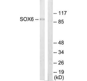 Western Blot - Anti-SOX6 Antibody (C10565) - Antibodies.com