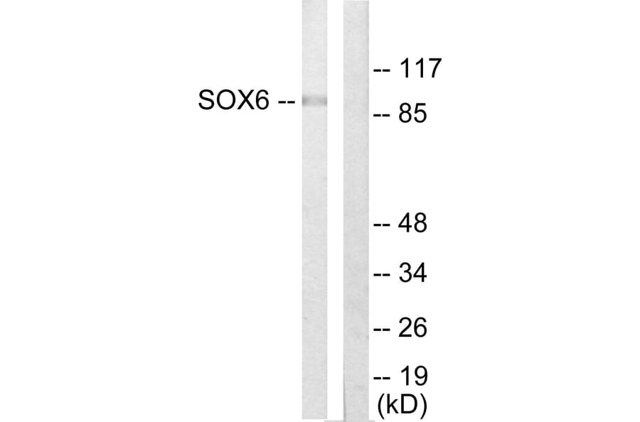Western Blot - Anti-SOX6 Antibody (C10565) - Antibodies.com