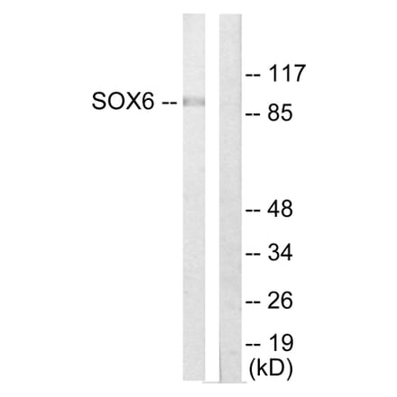 Western Blot - Anti-SOX6 Antibody (C10565) - Antibodies.com