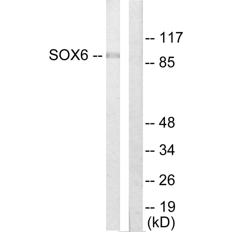 Western Blot - Anti-SOX6 Antibody (C10565) - Antibodies.com