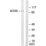 Western Blot - Anti-SOX6 Antibody (C10565) - Antibodies.com