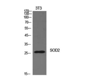 Western Blot - Anti-SOD2 Antibody (C30296) - Antibodies.com