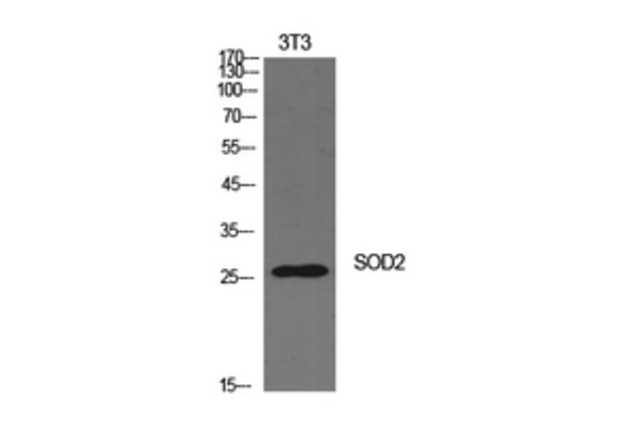 Western Blot - Anti-SOD2 Antibody (C30296) - Antibodies.com