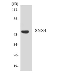 Western Blot - Anti-SNX4 Antibody (R12-3549) - Antibodies.com