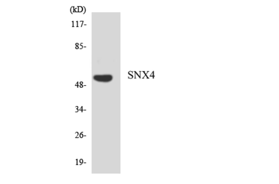 Western Blot - Anti-SNX4 Antibody (R12-3549) - Antibodies.com