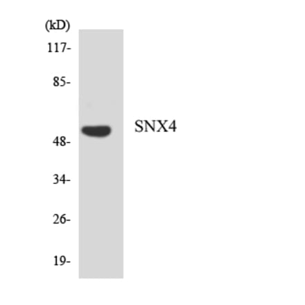 Western Blot - Anti-SNX4 Antibody (R12-3549) - Antibodies.com