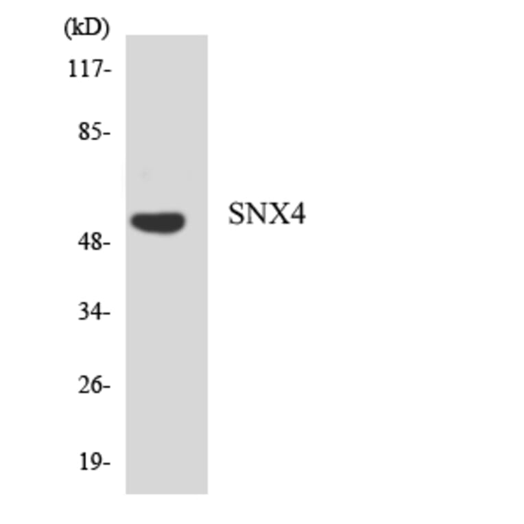 Western Blot - Anti-SNX4 Antibody (R12-3549) - Antibodies.com