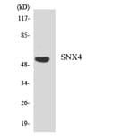 Western Blot - Anti-SNX4 Antibody (R12-3549) - Antibodies.com