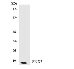 Western Blot - Anti-SNX3 Antibody (R12-3548) - Antibodies.com