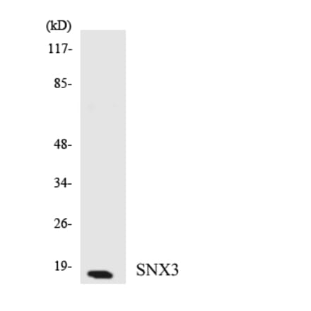 Western Blot - Anti-SNX3 Antibody (R12-3548) - Antibodies.com