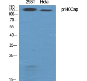 Western Blot - Anti-SNIP Antibody (C20903) - Antibodies.com