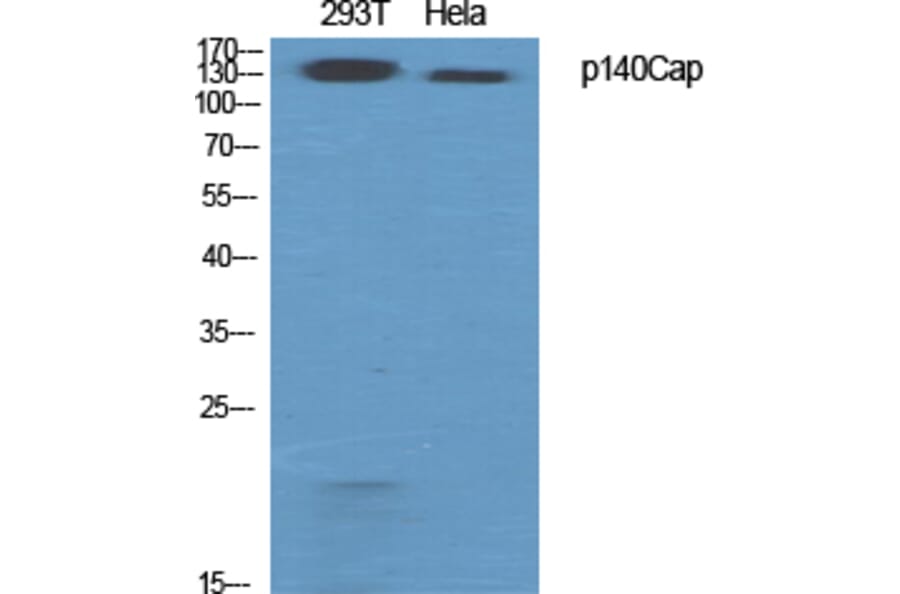 Western Blot - Anti-SNIP Antibody (C20903) - Antibodies.com