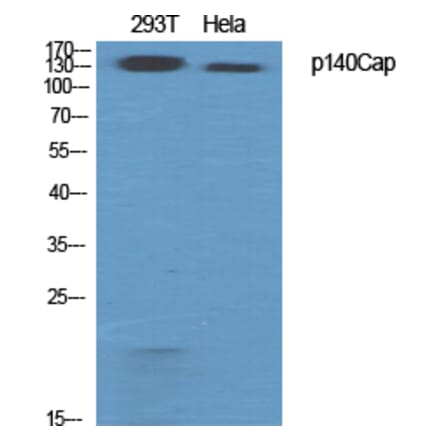 Western Blot - Anti-SNIP Antibody (C20903) - Antibodies.com
