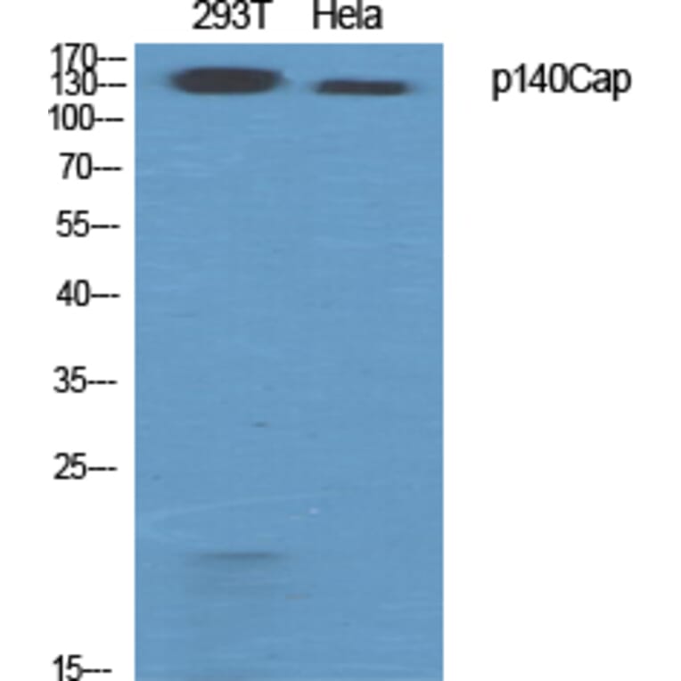 Western Blot - Anti-SNIP Antibody (C20903) - Antibodies.com