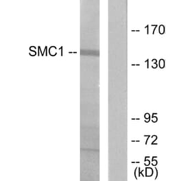Western Blot - Anti-SMC1 Antibody (B7217) - Antibodies.com