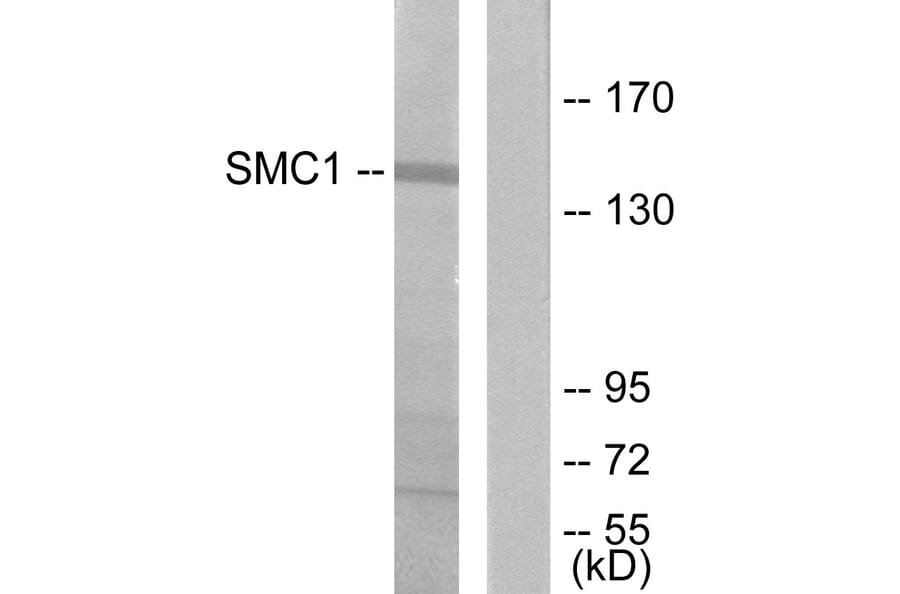 Western Blot - Anti-SMC1 Antibody (B7217) - Antibodies.com